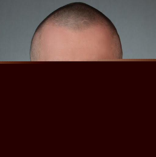 Michael Hummel Photo 23