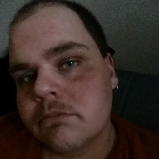Adam Anderson Photo 19