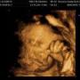 Elizabeth Byrd Photo 27