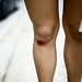 Kimberly Knee Photo 9